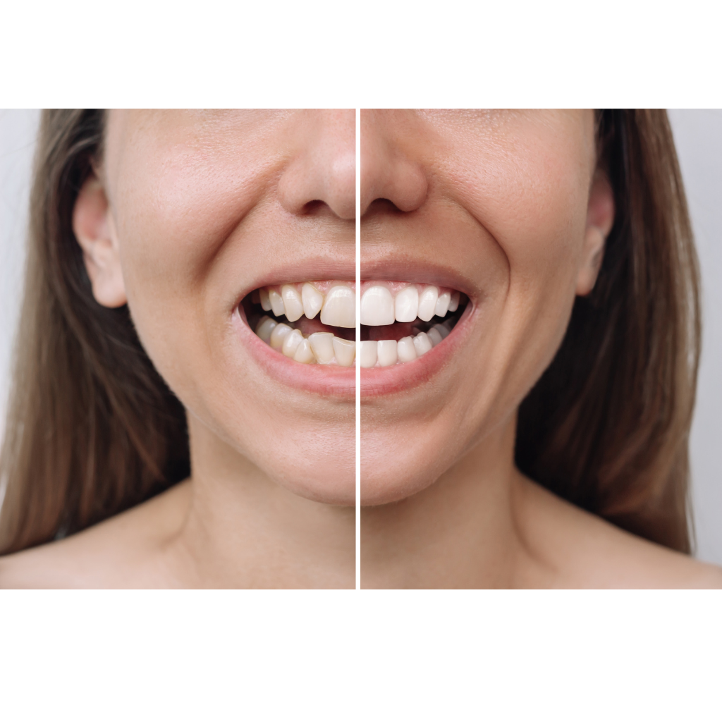 AI Smile Design Session