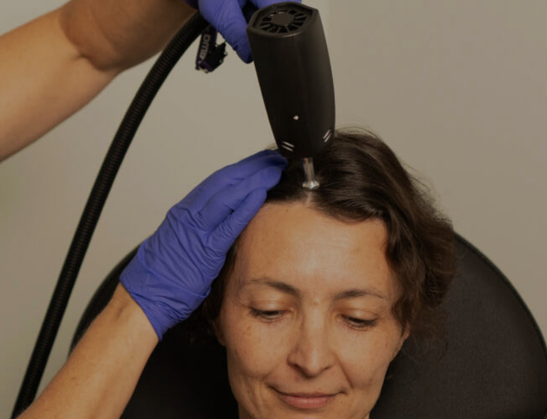 Alma TED® Hair-Unit Integration